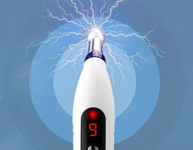 5-in-1 Electric Acupuncture Pen – Instant Pain Relief & Meridian Therapy