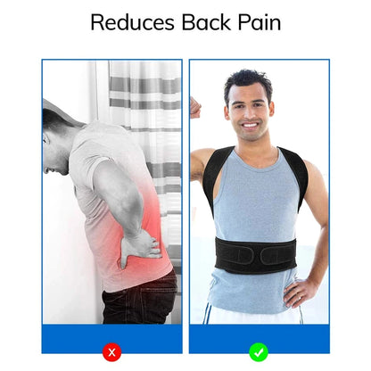 Back Brace Posture Corrector for Women & Men